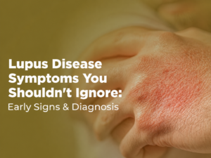 Early Signs and Symptoms of Lupus