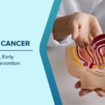 Early Warning Signs of Bladder Cancer