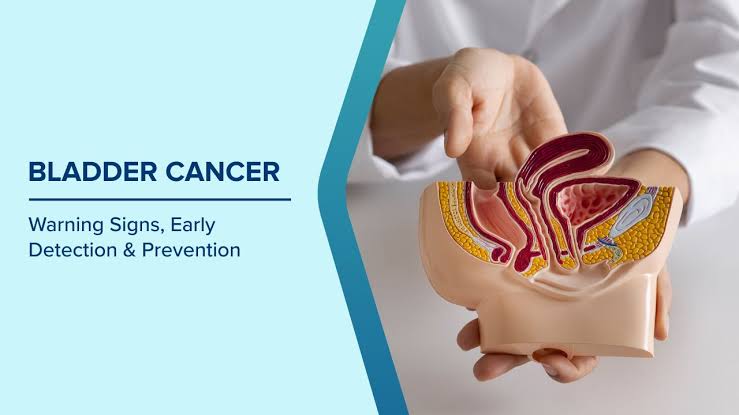 Early Warning Signs of Bladder Cancer