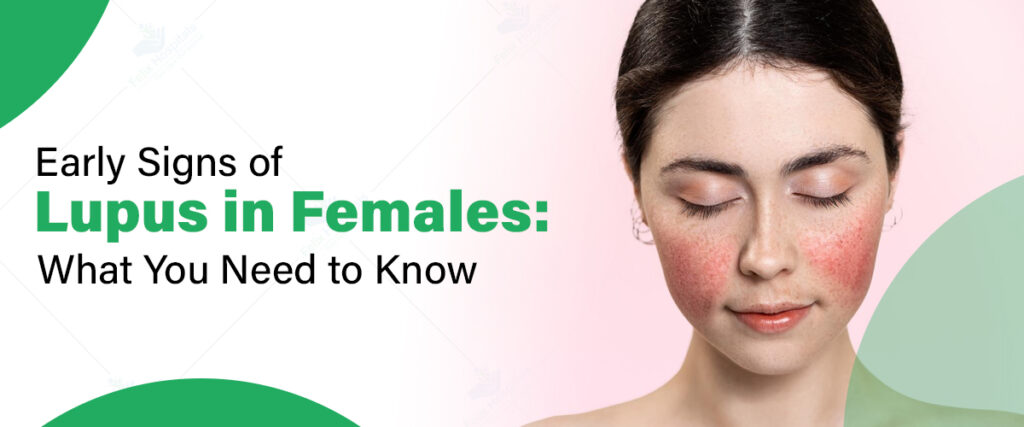 Early Signs and Symptoms of Lupus