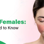 Early Signs and Symptoms of Lupus