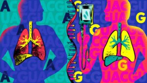 Biotech Gold Rush: The Race to Cure Alpha-1 Antitrypsin Deficiency (AATD)