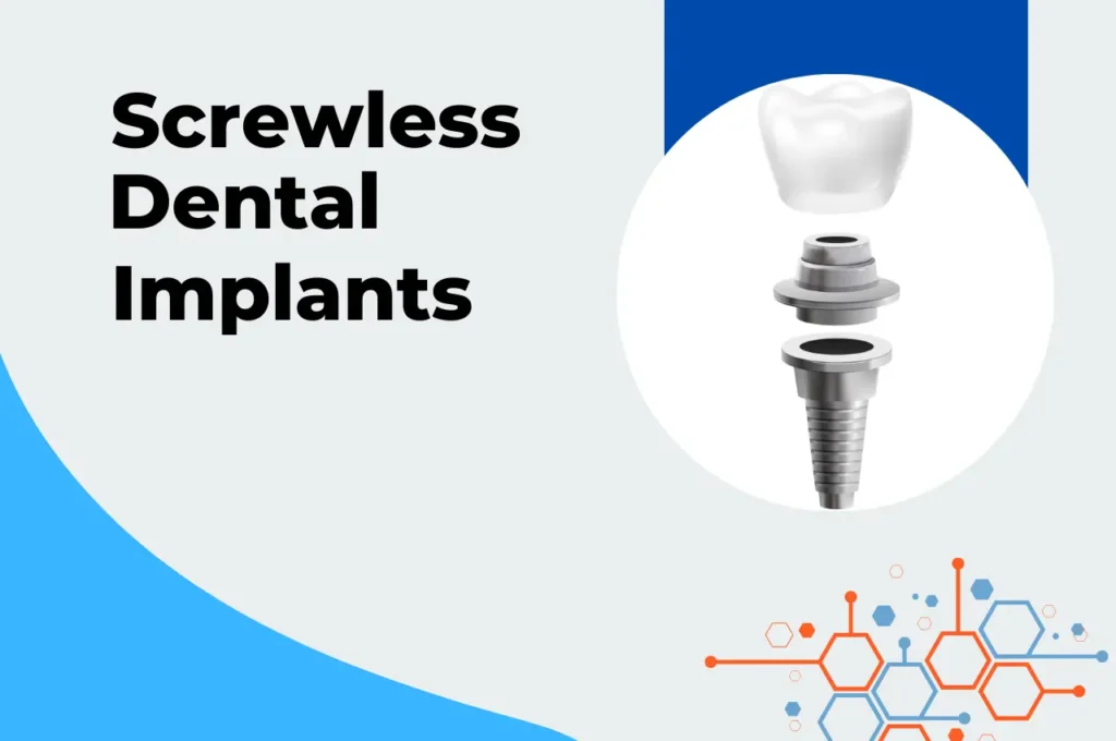 Screwless Dental Implants for Seniors