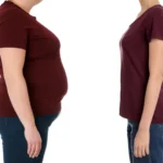 Why Weight Loss Alone May Not Shield Against Type 2 Diabetes: Insights from Recent Research