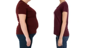 Why Weight Loss Alone May Not Shield Against Type 2 Diabetes: Insights from Recent Research
